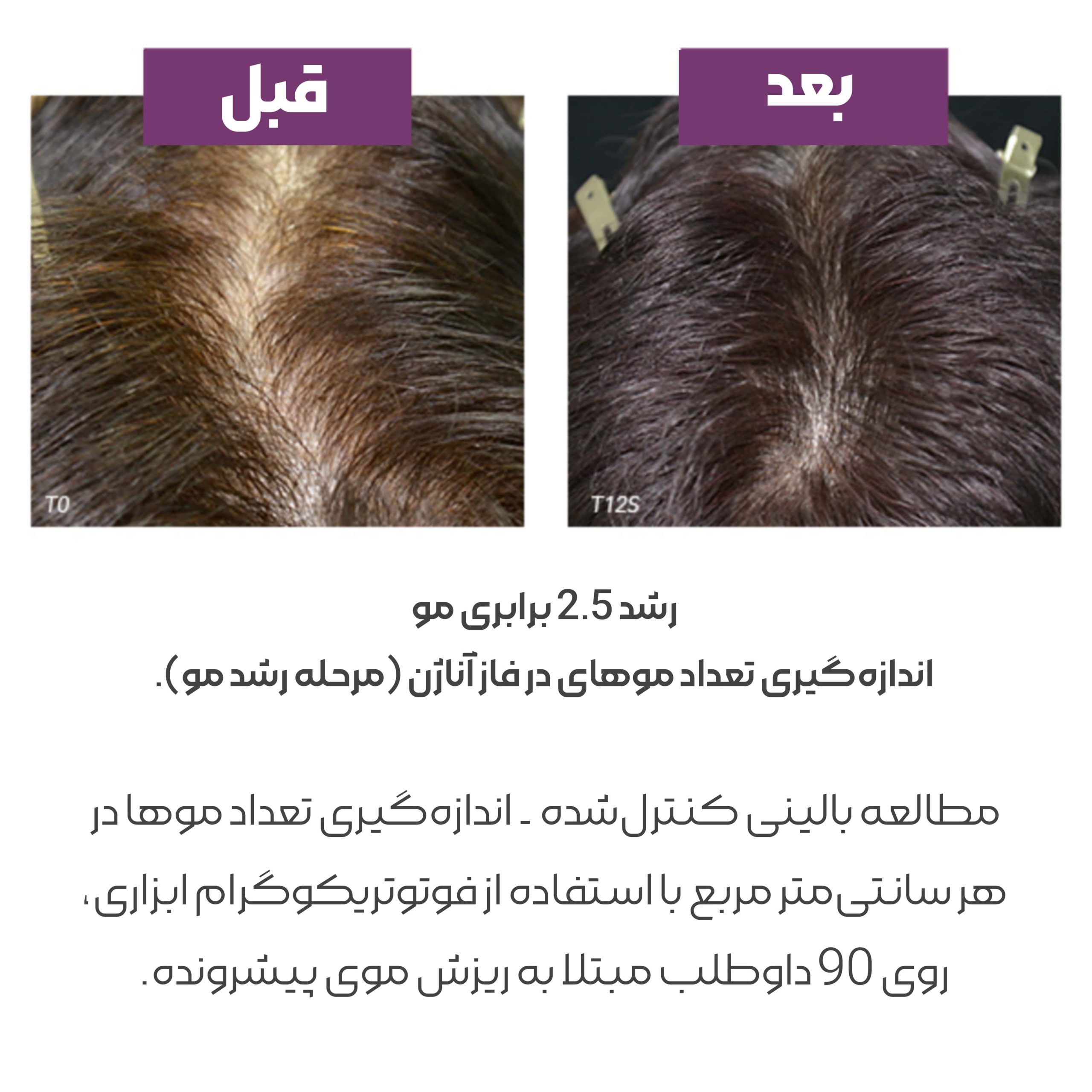 قرص ضد ریزش مو فیتو جدید فیتوسیان